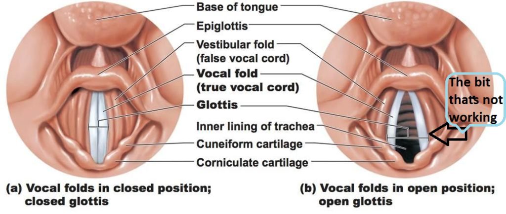 The bit thats not working vocal cords